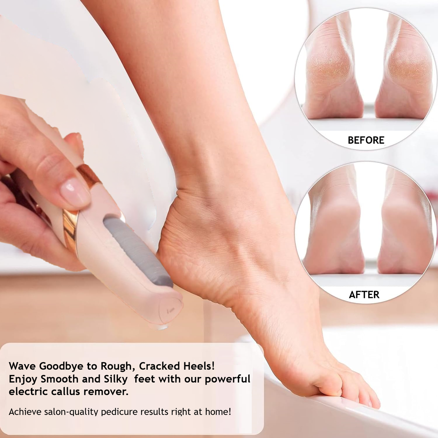 Ultimate Foot Care Set: Callus Remover & Manicure Magic